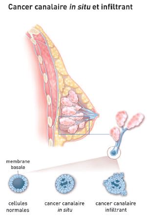 Anatomie cancer du sein @INCa