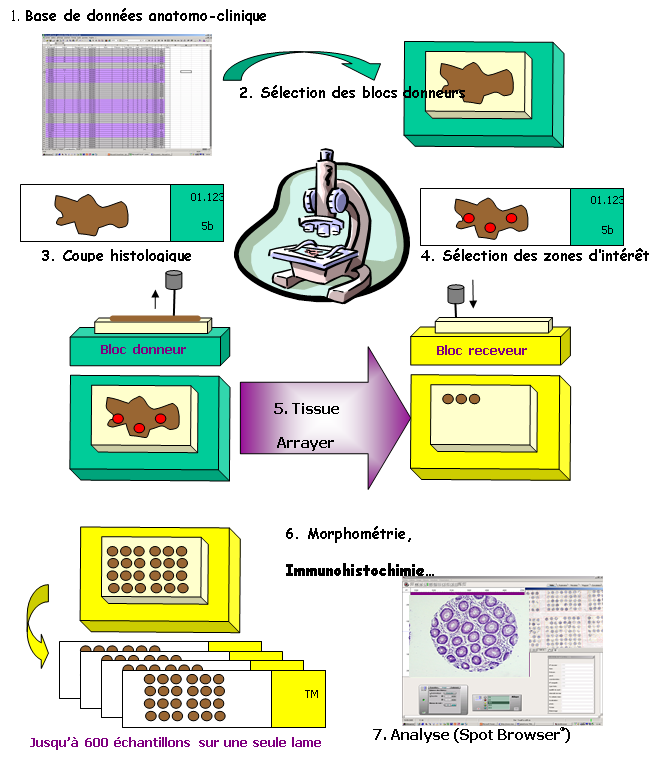 Recherche translationnelle ICM 