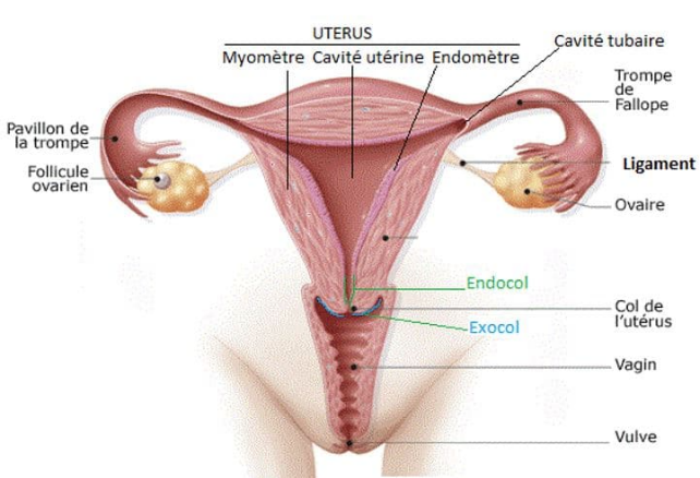 Cancers gynécologiques ICM 