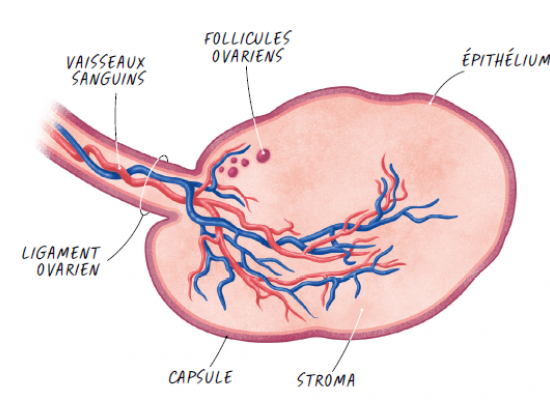 cancers gynécologiques ICM 