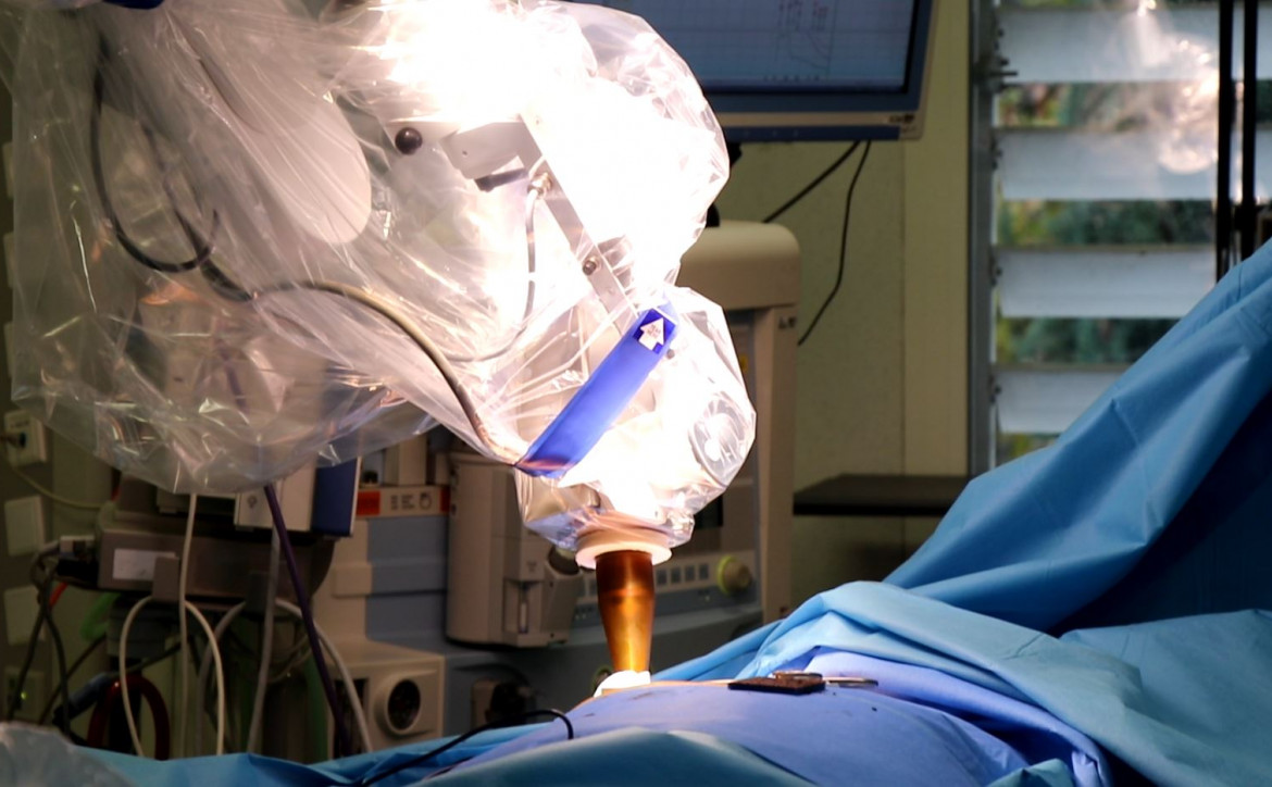 Séance de radiothérapie peropératoire