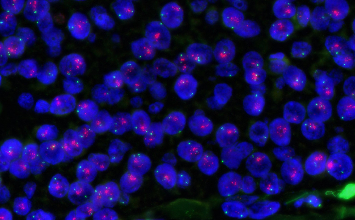 anatomo-pathologie à l'ICM