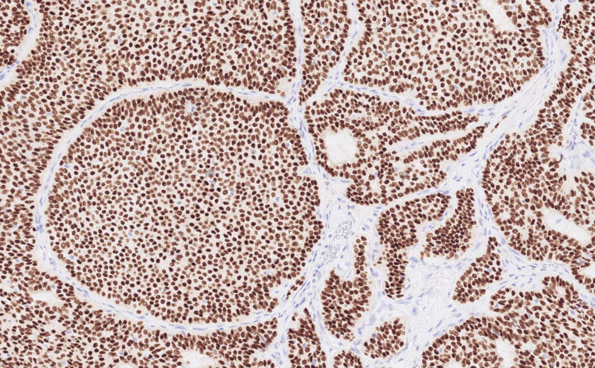 anatomo-pathologie à l'ICM