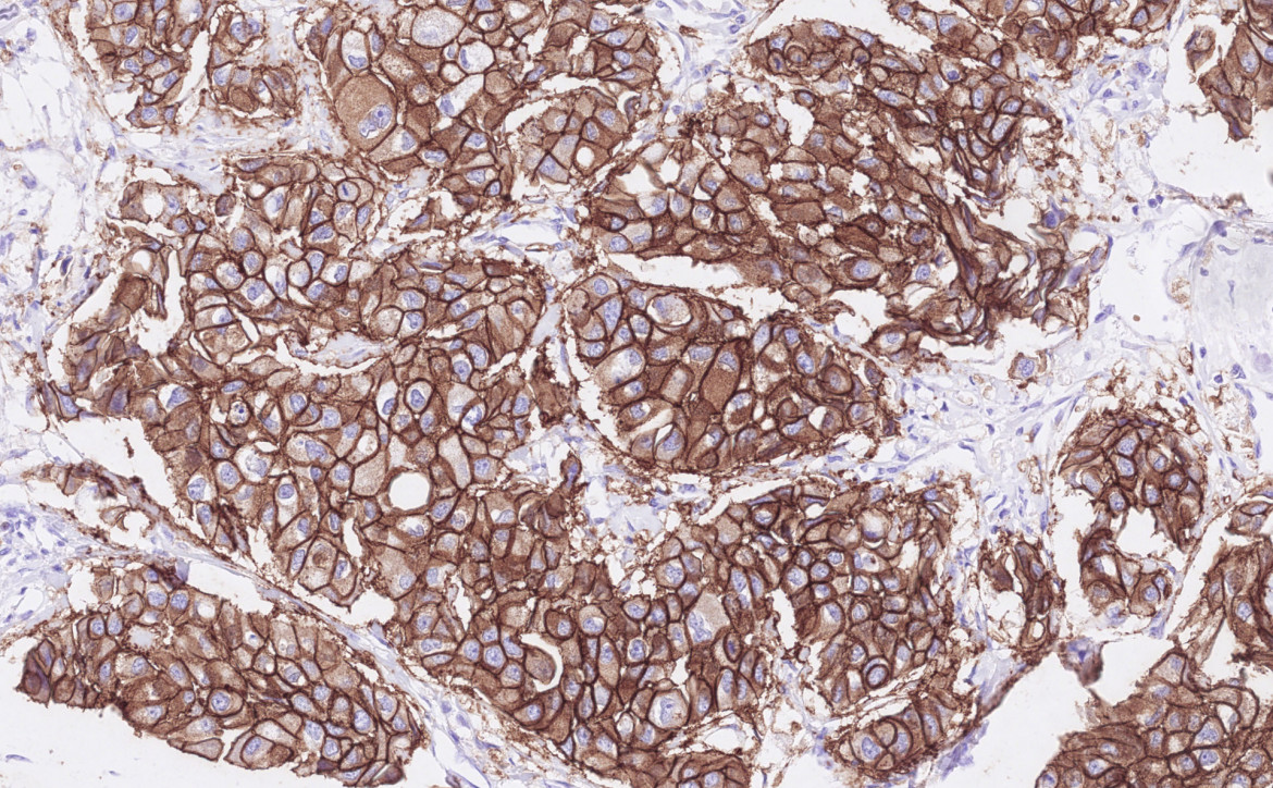 anatomo-pathologie à l'ICM