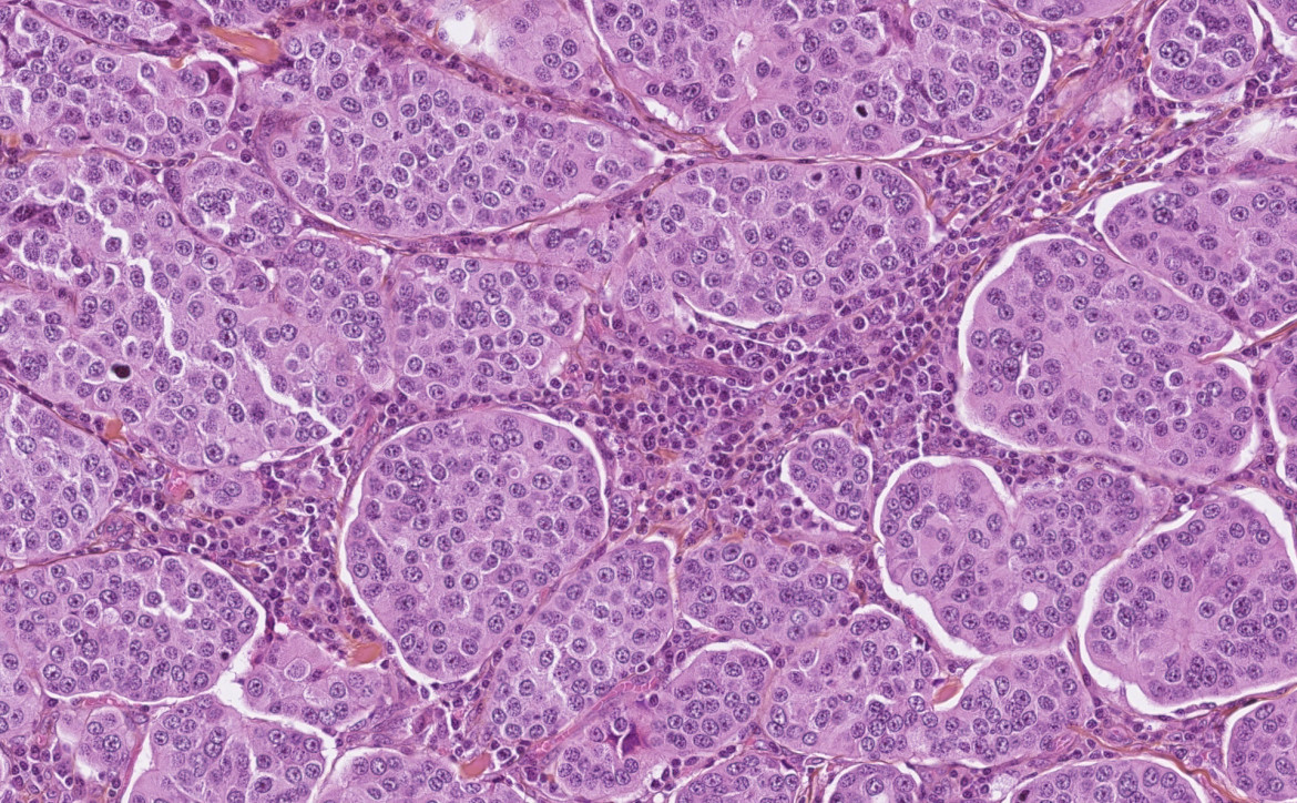 anatomo-pathologie à l'ICM