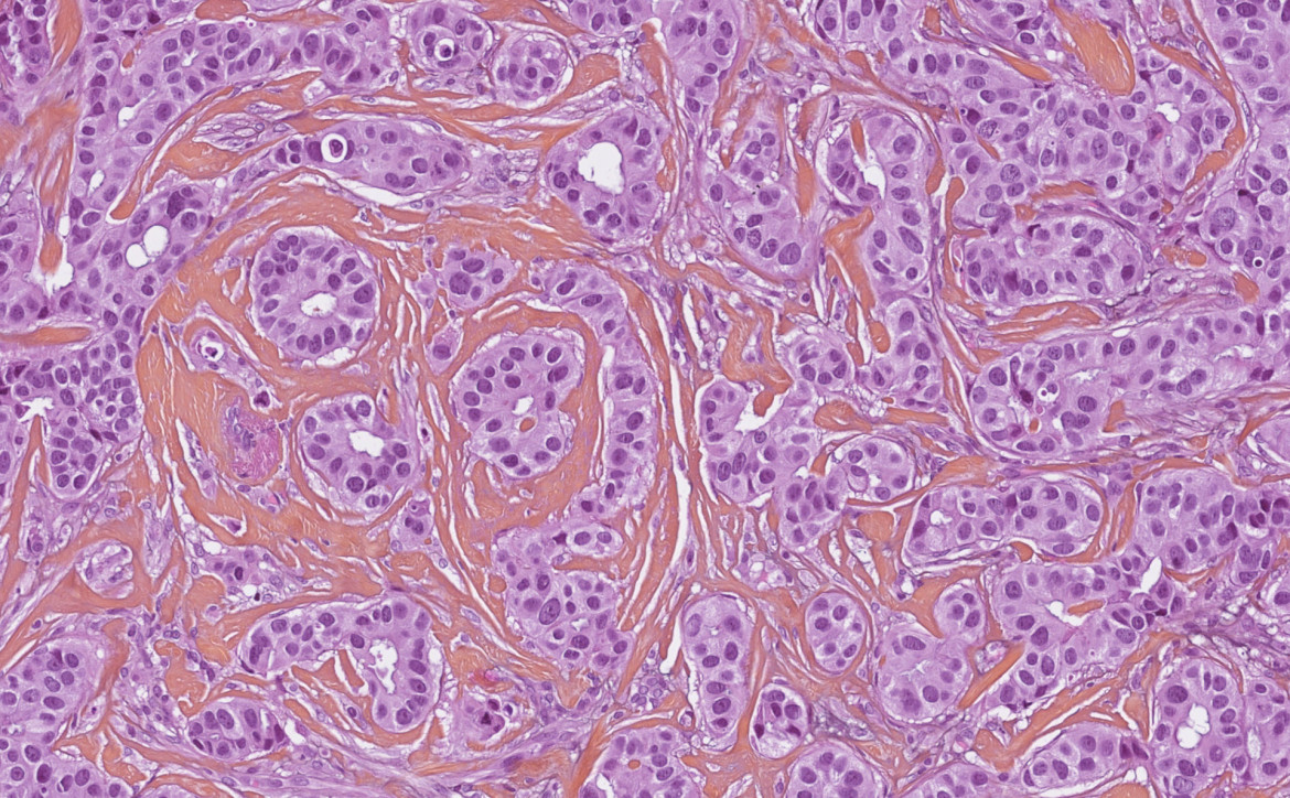 anatomo-pathologie à l'ICM