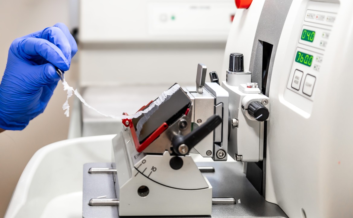 recherche clinique ICM